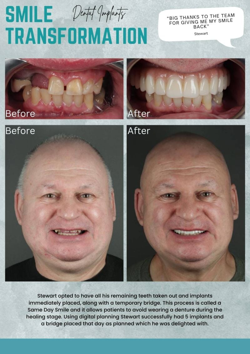 helping to transform Your smile
And Your Confidence