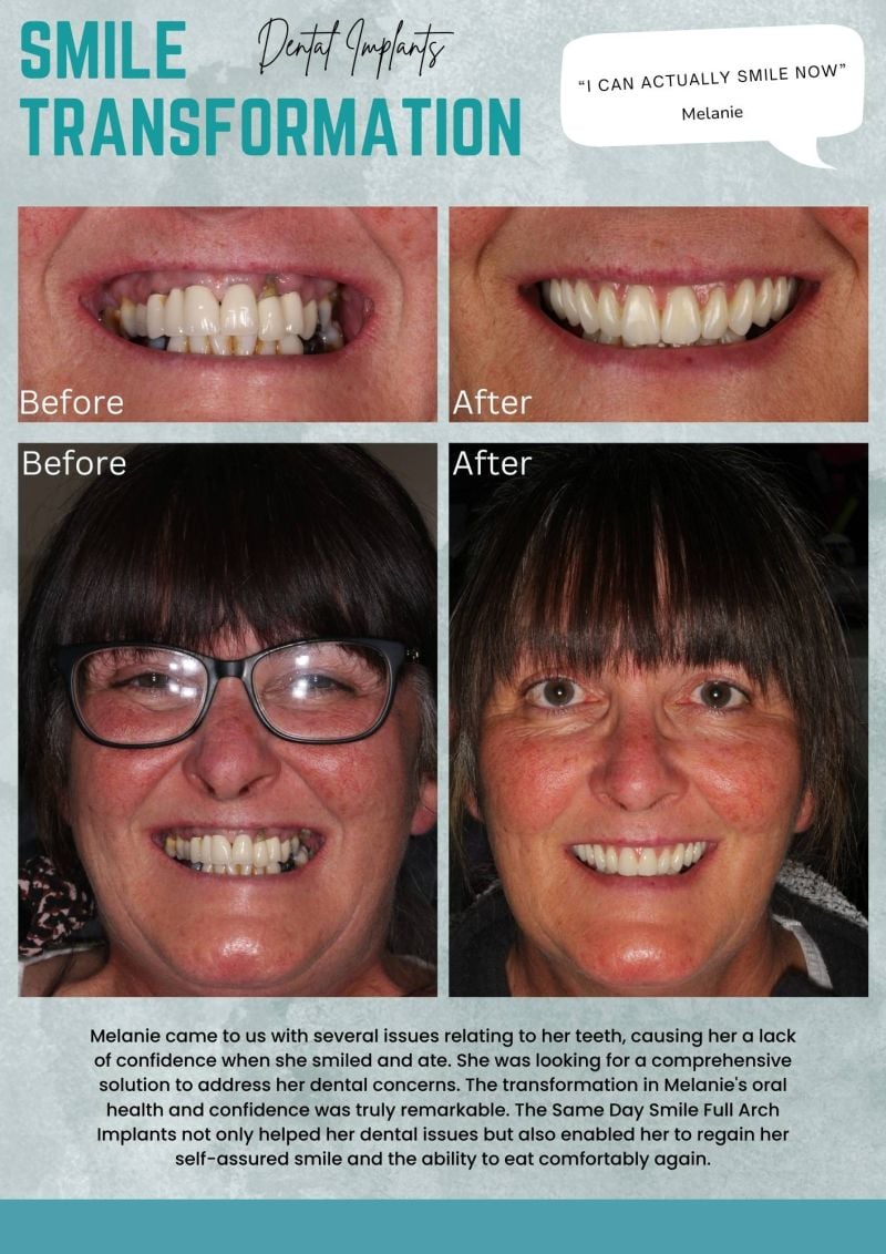 helping to transform Your smile
And Your Confidence