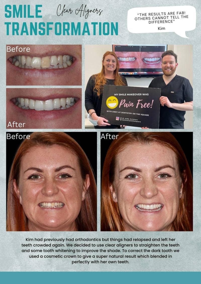 helping to transform Your smile
And Your Confidence